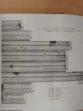 A mesterséges hibernatio