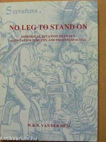 No Leg to Stand on
