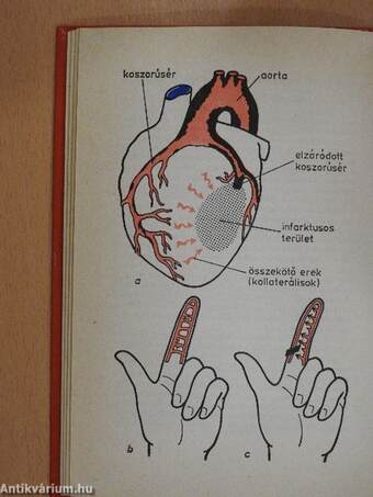 Szív- és érbetegségekről mindenkinek