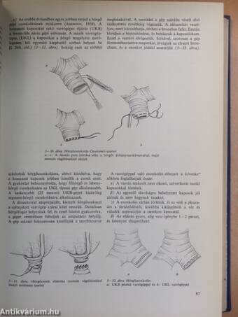 Sebészeti műtéttan