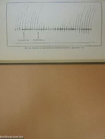 Cough and its management