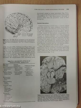 Diseases of the Nervous System - Clinical Neurobiology II. (töredék)