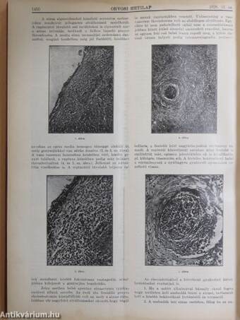 Orvosi Hetilap 1928. (nem teljes évfolyam)