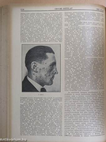 Orvosi Hetilap 1929. július-december (fél évfolyam)/Az orvosi gyakorlat kérdései 1929/1-52.