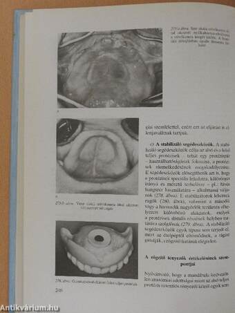 Klinikai fogpótlástan