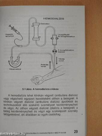 Hogyan oldja fel és távolítsa el vesekövét fájdalom mentesen 24 óra alatt