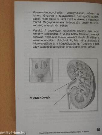 Hogyan oldja fel és távolítsa el vesekövét fájdalom mentesen 24 óra alatt