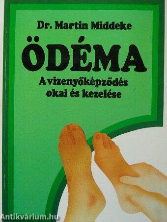 Ödéma