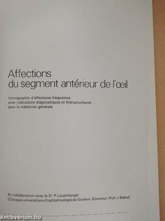 Affections du segment antérieur de l'oeil