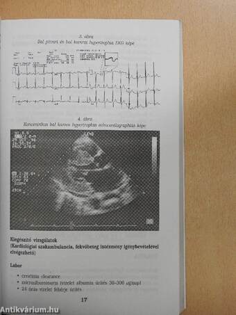 Kardiológiai füveskönyv