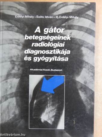 A gátor betegségeinek radiológiai diagnosztikája és gyógyítása