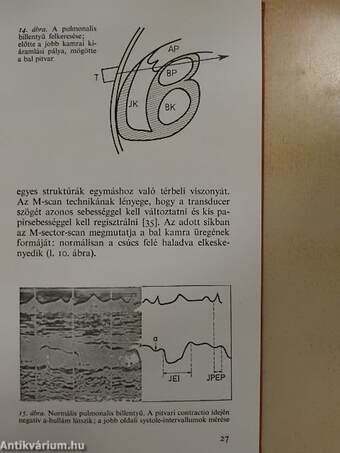 Echocardiographia