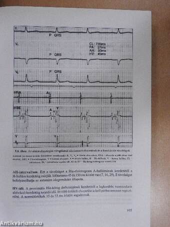 Klinikai szív-elektrofiziológia és aritmológia