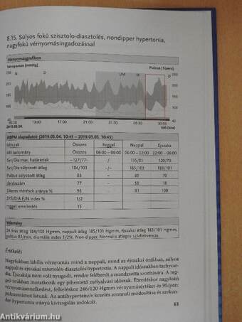 A vérnyomás mérése - ABPM a mindennapi gyakorlatban