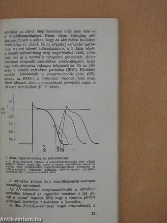 A ritmuszavarok diagnózisa és terápiája