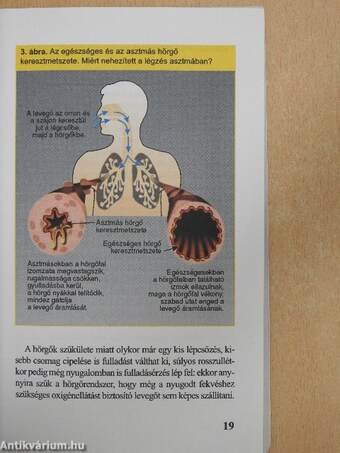 Asztmás vagyok - mit tegyek?