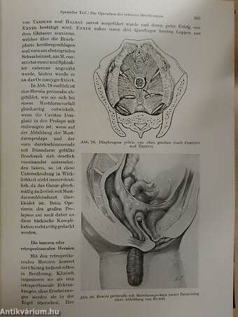 Chirurgische Operationslehre V