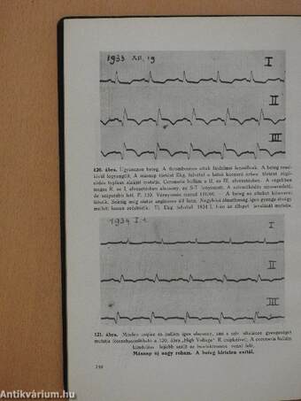 Elektrokardiographia