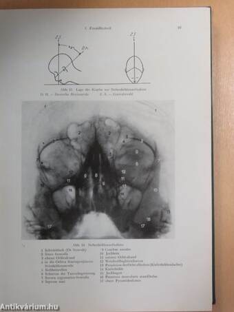 Ophthalmologische Röntgendiagnostik