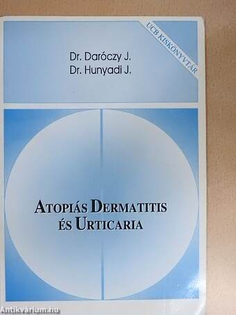 Atopiás Dermatitis és Urticaria