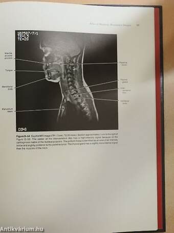 Magnetic Resonance Imaging Of the Brain, Head, and Neck