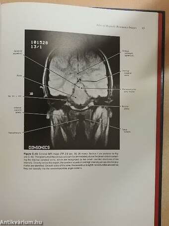 Magnetic Resonance Imaging Of the Brain, Head, and Neck