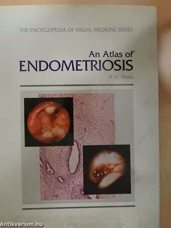 An Atlas of Endometriosis