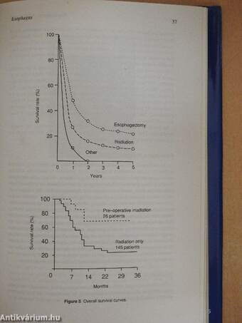 Brachytherapy HDR and LDR