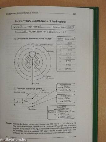 Brachytherapy of Prostatic Cancer