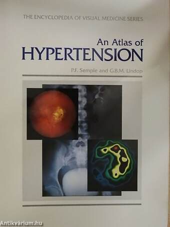 An Atlas of Hypertension