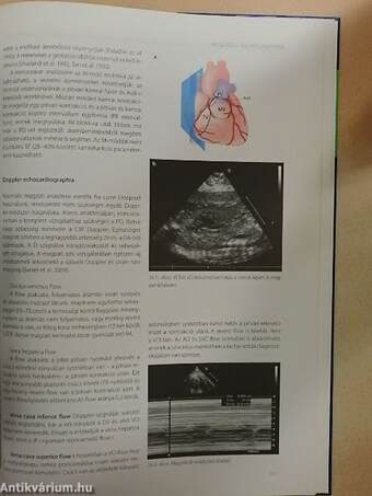 Echocardiographia