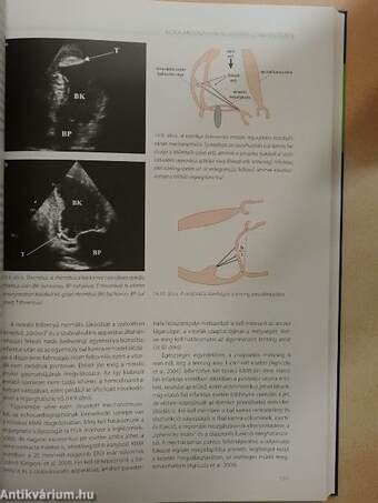 Echocardiographia