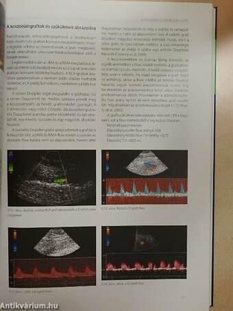 Echocardiographia