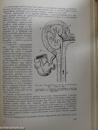 A hasüreg sebészeti diagnosztikája