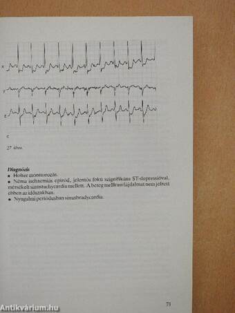 EKG atlasz