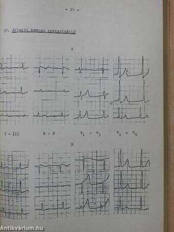 EKG-Atlasz