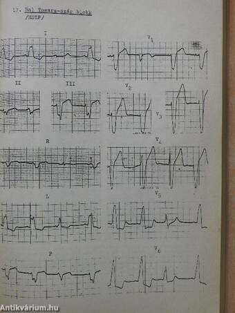 EKG-Atlasz