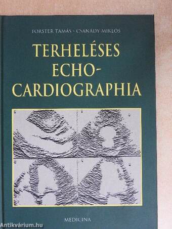 Terheléses echocardiographia