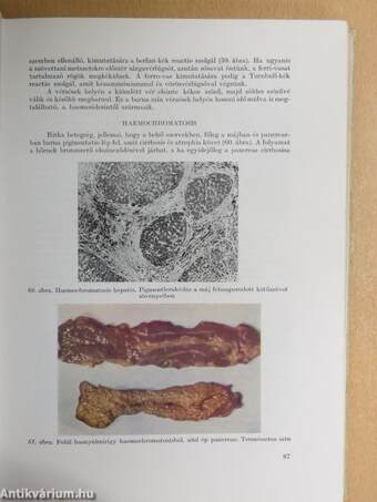 Az általános kórbonctan tankönyve