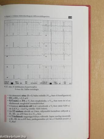 EKG a gyermekkorban