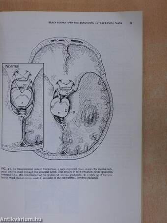 Neuropathology