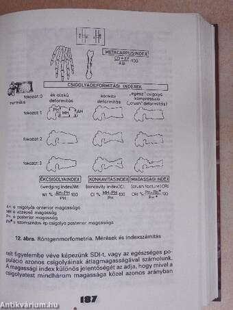 A kalciumháztartás és a csontszövet anyagcsere-betegségei