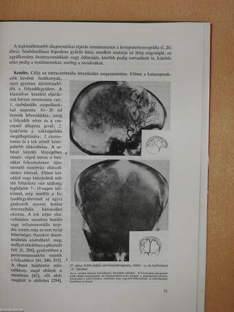 Csecsemő- és gyermekneurológia (dedikált példány)