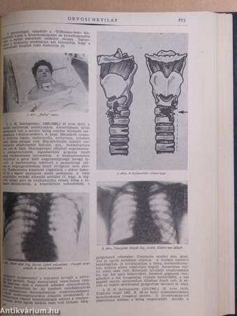 Orvosi Hetilap 1964. január-december I-II.