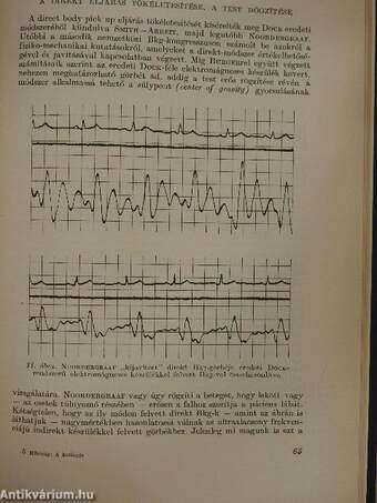 A keringés ballistokardiographiás vizsgálata