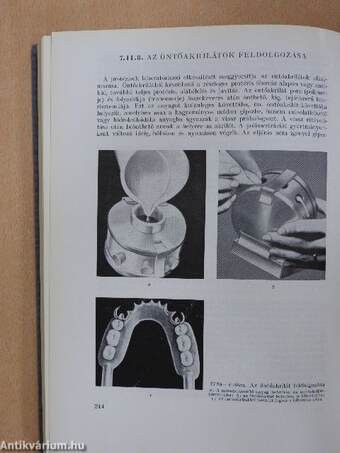 A fogpótlás technológiája