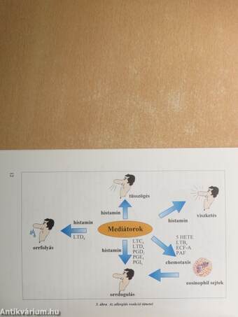 Allergiás Rhinitis