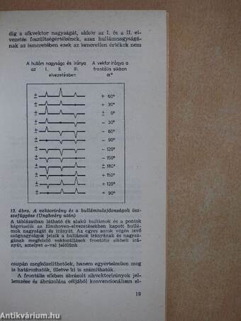 Gyakorlati elektrokardiográfia