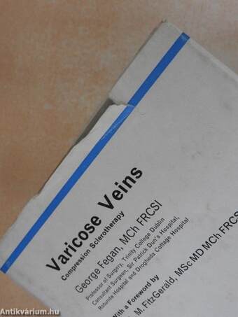 Varicose Veins