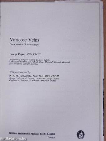 Varicose Veins